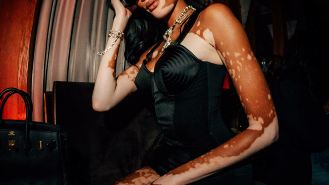 winnie harlow